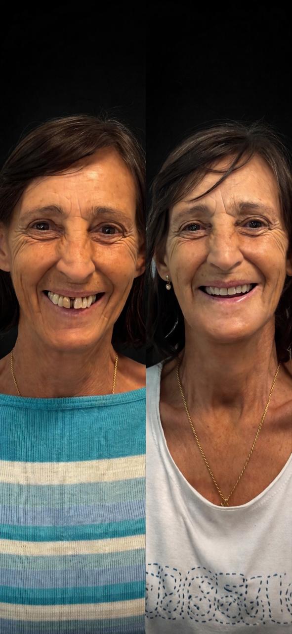 Resultado de tratamento — paciente 2